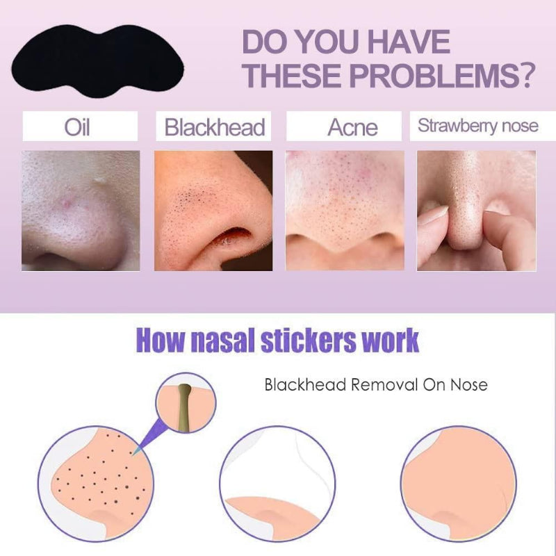 Deep Cleansing Bamboo Charcoal Blackhead Remover Nose Strips – Pack of 20