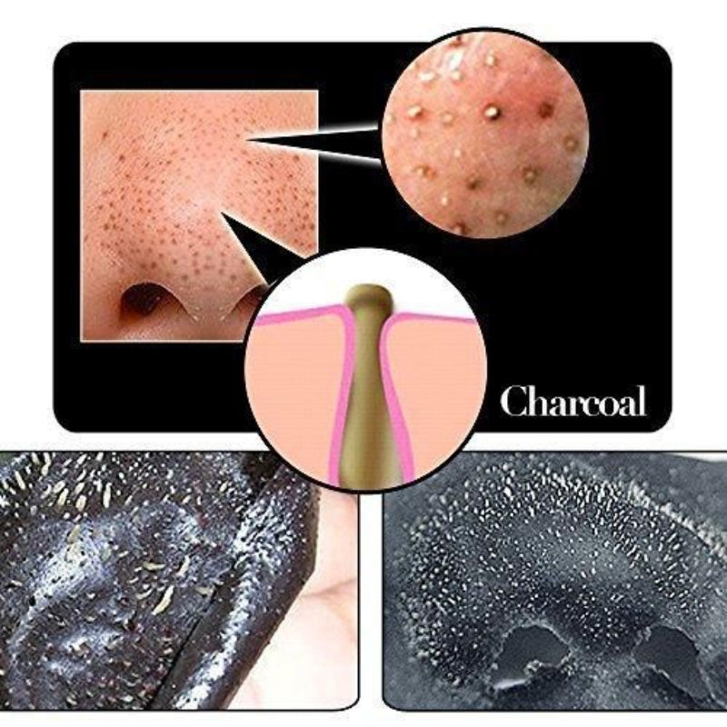Deep Cleansing Bamboo Charcoal Blackhead Remover Nose Strips – Pack of 20