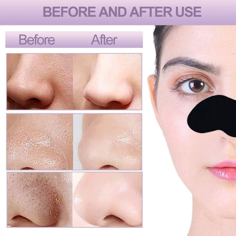 Deep Cleansing Bamboo Charcoal Blackhead Remover Nose Strips – Pack of 20